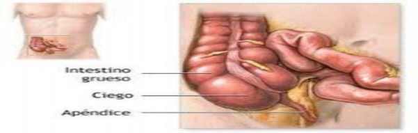 Resultado de imagen para cuÃ¡les son los problemas de cicatrizaciÃ³n postoperatoria en una apendicitis